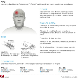 infogrfico sobre avc