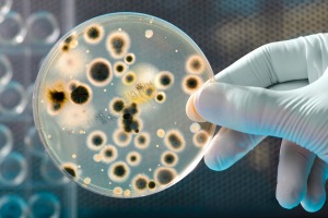 imagem de placa de petri com bacilus