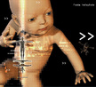 cido desoxirribonucleico (ADN ou DNA, em ingls Deoxyribonucleic acid)  uma molcula orgnica que contm a "informao" que coordena o desenvolvimento e funcionamento de todos os organismos vivos.  <br/><br/> Palavras-chave: Gentica. Reproduo. Sociologia. Filosofia.  tica. Medicina. ADN. Molcula. 