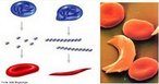 Apresenta uma comparao da morfologia de hemcias comuns e hemcias falciformes. A m-formao de hemcias com formato semelhante a foice (falciforme) caracteriza a doena hereditria anemia falciforme. Essa anomalia provoca deficincia no transporte de gases s clulas do organismo. <br/><br/> Palavras-chave: Glbulos vermelhos. Gentica. Anemia. Patologia. Transporte de gases. Eritrcitos. Hereditariedade. 