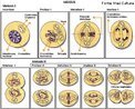 Diviso Celular onde ocorre a formao de quatro clulas com a metade do nmero de cromossomos existentes na clula que deu origem  diviso. Apresenta-se em duas etapas: Reducional (Meiose I) e Equacional (Meiose II). <br/><br/> Palavras-chave: Diviso. Celular. Diplides. Haplides. Sexuais. Gametas. Esporos. Crossing-over. Meitica. Etapas.  