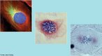 Corresponde ao processo inicial de diviso mittica das clulas. Nesta etapa da mitose, os cromossomos condensam-se, tornando-se visveis; a carioteca e os nuclolos desintegram-se; os centrolos dividem-se e dirigem-se para os plos da clula e ocorre a formao do fuso de diviso (fibras proticas). <br/><br/> Palavras-chave: Citologia, diviso celular, clulas somticas, mitose, cromossomos. 