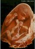 Etapa do desenvolvimento embrionário. No 7º mês de gestação o cérebro ainda está crescendo rapidamente. O feto pode ouvir sons e seus olhos reagem à luz. Os pulmões estão prontos para respirar ar. Cabelos, sobrancelhas e cílios estão presentes. <br/><br/> Palavras-chave: Embriologia, gestação, embrião, desenvolvimento. 