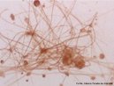 Viso microscpica de clulas de bolores da espcie Rhizopus nigricans pertencentes a famlia Mucoraceae. Aumento de 60x. <br/><br/> Palavras-chave: Microscopia. Clulas. Fungos. Mucoraceae. Bolores. 