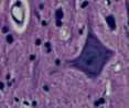Imagem que mostra as estruturas presentes na medula espinal. Palavras-chave: Histologia. Tecidos. Neurônios. Vasos sanguíneos. Substância branca. Substância cinzenta.