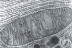 Eletromicrografia de mitocndria