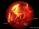 Etapa do desenvolvimento embrionrio. No 8 ms de gestao o beb coloca-se de barriga para baixo ( se ainda no o fez antes), a cada dia dispe de menos espao para se mexer. Os olhos se abrem na fase de alerta e se fecham durante o sono. O comprimento do feto  de aproximadamente 29 cm e seu peso  de 1800 g. <br/><br/> Palavras-chave: Embriologia, gestao, embrio, desenvolvimento. 