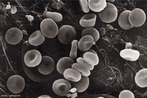 Células vermelhas pertencentes aos elementos figurados do sangue. São responsáveis pelo transporte de oxigênio e nutrientes às demais células do corpo. <br/><br/> Palavras-chave: eritrócitos, glóbulos vermelhos, hemoglobina, elementos figurados, sangue. 