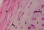 Fotomicrografia de cartilagem hialina. Colorao por Hematoxilina Eosina. Observa-se: Pericndrio (indicado pelo asterisco), condroblastos (indicados pela seta curta), condrcitos (indicados pela seta longa), matriz territorial ( indicada pelo nmero 1) e matriz interterritorial (indicada pelo nmero 2). <br/><br/> Palavras-chave: Anatomia. Histologia. Cartilagem. Traquia. Esfago.  