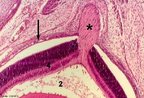 Fotomicrografia de Nervo óptico (indicado pelo asterisco). Coloração por Hematoxilina Eosina. Observa-se: coróide, camada rica em vasos sanguíneos (indicada pela seta longa); entre os vasos observa-se tecido conjuntivo rico em fibras colágenas e elásticas (indicado pelo número 4) e esclera, região que limita o conjuntivo do globo ocular. Formada por uma camada de tecido conjuntivo fibroso denso, opaco e vascularizado. Corresponde ao branco do olho (indicada pelo número 2). <br/><br/> Palavras-chave: Anatomia. Histologia. Nervo. Óptico. Visão. Fibras. 