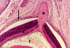 Fotomicrografia de Nervo ptico (indicado pelo asterisco). Colorao por Hematoxilina Eosina. Observa-se: coride, camada rica em vasos sanguneos (indicada pela seta longa); entre os vasos observa-se tecido conjuntivo rico em fibras colgenas e elsticas (indicado pelo nmero 4) e esclera, regio que limita o conjuntivo do globo ocular. Formada por uma camada de tecido conjuntivo fibroso denso, opaco e vascularizado. Corresponde ao branco do olho (indicada pelo nmero 2). <br/><br/> Palavras-chave: Anatomia. Histologia. Nervo. ptico. Viso. Fibras. 