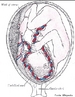 Ilustrao do desenvolvimento de um feto no tero humano, entre o quinto e o sexto ms. <br/><br/> Palavras-chave: feto, tero, humano, ms, mecanismo biolgico, Biologia, Cincias. 