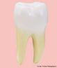 Dente situado na parte posterior da mandíbula, tem a função de triturar e moer os alimentos. <br/><br/> Palavras-chave: odontologia, oclusão dentária, esmalte, dentina, polpa, cemento, multicúspides.  