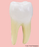 Dente molar