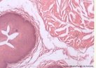 Visão microscópica de traqueia e esôfago, mostrando a cartilagem hialina e o epitélio estratificado e ciliado. Coloração hematoxilina Eosina. Aumento de 200x. <br/><br/> Palavras-chave: Histologia. Cartilagem. Tecidos. Anel. Cílios.  