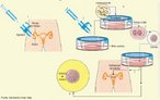  um processo que controla hormonalmente a ovulao, remove o ovcito do ovrio e deixa o espermatozide fecund-lo em meio fluido. O ovo fertilizado (zigoto)  ento transferido para o tero da mulher com a finalidade de estabelecer gravidez bem sucedida. <br/><br/> Palavras-chave: reproduo assitida, beb de proveta, infertilidade, tubas uterinas, ovrios, gravidez, tero. 
