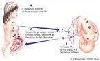 Eritroblastose fetal