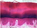 O tecido estratificado é formado por várias camadas de células. A imagem apresenta corte transversal de secção de pele grossa mostrando o tecido epitelial estratificado. Quanto mais grosso o epitélio, melhor sua capacidade protetora; quanto mais fino, melhor sua capacidade de absorção.
