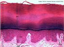 O tecido estratificado  formado por vrias camadas de clulas. A imagem apresenta corte transversal de seco de pele grossa mostrando o tecido epitelial estratificado. Quanto mais grosso o epitlio, melhor sua capacidade protetora; quanto mais fino, melhor sua capacidade de absoro.