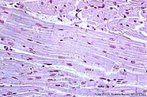 Formado por clulas cilndricas, longas e pluricelulares. Com estrias transversais e movimento voluntrio. Prendem-se aos ossos e atuam nos movimentos do corpo. <br/><br/> Palavras-chave: Histologia. Msculos. Estrias. Movimentos. Voluntrio. Sustentao. 