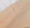 Técnica que corresponde a introdução de agulhas muito finas em pontos precisos do corpo para aliviar a dor. <br/><br/> Palavras-chave: Técnica que corresponde a introdução de agulhas muito finas em pontos precisos do corpo para aliviar a dor.