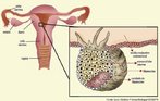 Representação da ligação do blastocisto ao epitélio do endométrio. O blastocisto, estágio de desenvolvimento da blástula, é formado por uma camada interna de células que origina o embrião propriamente dito e uma dupla camada de células, o trofoblasto, que é o precursor do córion.  <br/><br/> Palavras-chave: Embriologia, desenvolvimento embrionário, cavidade uterina, endométrio, gestação. 