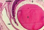 Fotomicrografia do olho. Colorao por Hematoxilina Eosina. Observa-se: crnea, lmina de tecido conjuntivo denso, transparente e avascular, que limita anteriormente o globo ocular (indicada pela seta curta); coride (indicada pela seta longa); ris (indicada pelo nmero 1), prolongamento membranoso da coride; corpo vtreo (indicado pelo nmero 2); cristalino (indicado pelo nmero 3) e retina (indicada pelo nmero 4).