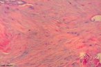 Fotomicrografia de cartilagem fibrosa. Coloração por Hematoxilina Eosina. <br/><br/> Palavras-chave: Anatomia. Histologia. Cartilagem. Joelho. Articulação. Fêmurotibial.  