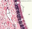 O corte transversal de traquéia demonstra camada de células com núcleos de alturas diferentes, características do tecido epitelial pseudoestratificado. <br/><br/> Palavras-chave: Histologia. Epitélios. Pele. Mucosas. Proteção. Revestimento. 