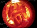 Etapa do desenvolvimento embrionário. No 5º mês de gestação os dedos e orelhas são bem visíveis. Os movimentos do feto dentro do útero podem ser sentidos pela mãe. O feto pisca os olhos, engole e tem fases de sono e vigília. As impressões digitais aparecem na ponta dos dedos. <br/><br/> Palavras-chave: Embriologia, gestação, embrião, desenvolvimento. 