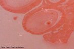 Visão microscópica de ovário mostrando o núcleo. Aumento de 60x. <br/><br/> Palavras-chave: Sistema. Reprodutor. Ovários. ovulogênese. Microscopia. 