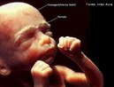 Etapa do desenvolvimento embrionário. No 6º mês de gestação o bebê muda de posição freqüentemente. Ganha peso rapidamente e a audição está mais avançada, pode ouvir e distinguir a voz da mãe. <br/><br/> Palavras-chave: Embriologia, gestação, embrião, desenvolvimento.  