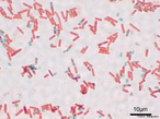 Ilustra colnias de bactrias do tipo morfolgico bacilo. Algumas espcies participam da flora intestinal, enquanto outras provocam patologias na espcie humana.  <br /> Palavra-chave: Reino Monera, bastonetes retos, procariontes.