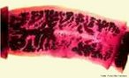 Proglote corresponde a cada um dos segmentos ou anis que constituem o corpo de taenia solium ou saginata, que se destacam e so eliminados nas fezes.<br /> <br /> Palavra-chave: platelmintes, cestoda, sunos, bovinos, solitria, ovos.