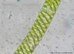 Alga filamentosa de coloração verde, encontrada em ambientes de água doce. Apresenta parede celular composta por duas camadas: a camada externa é formada por pectina, enquanto a interna é revestida por celulose.<br/> <br/> Palavras-chave: Chlorophyta, filamentos, protista. 