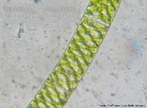 Spirogyra