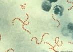 Bactérias do tipo estreptococos causam a faringite, vivem em colônias lineares ou em pares.<br /> <br /> palavra-chave: Bactérias. Estreptococos. Colônias. Linear. Par. Faringite. Biologia. Microbiologia. Ciências. 