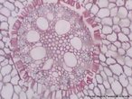 Visão microscópica de raiz de monocotiledônea, em corte transversal, de Iris germanica (Lírio). Aumento em 200x.<br /> <br /> palavra-chave: Iridaceae. Histologia. Vegetal. Angiospermas. Monocotiledôneas. Microscopia.