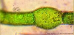 Contribuição da Professora Vera Lucia Bellin Mariano. Alga verde filamentosa simples, apresenta estrutura celular. Algumas células do filamento apresentam anéis de crescimento (capuz).<br /> <br /> palavra-chave: Chlorophyta, Oedogoniales, protista.