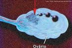 Hormônio de natureza glicoproteica produzido pela hipófise. Na mulher, estimula o amadurecimento do Folículo de Graaf do ovário e a secreção de estrógenos; no homem, é parcialmente responsável pela indução da espermatogênese. <br /> <br /> Palavra-chave: Reprodução, ovulogênese, espermatogênese, endócrino, hipotálamo, óvários, testículos.