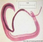 Verme achatado, endoparasita pertencente a classe trematoda e causador da doena esquistossomose na espcies humana. Apresenta, na fase adulta, dimorfismo sexual.<br /> <br /> Palavra-chave: platelmintes, barriga d'gua, cercrias, miracdios, gua parada, esquistossomose.